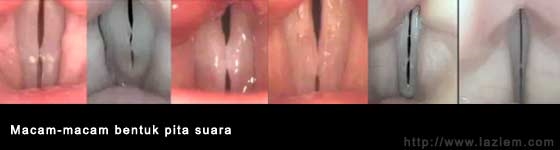 macam_pita_suara